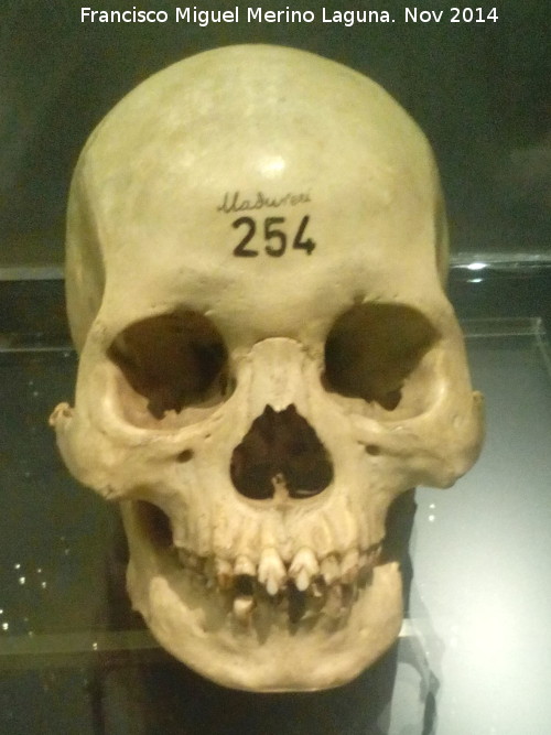Museo de Antropología - Museo de Antropología. Cráneo de Hombre Tamil. Madurai - India 2000 años de antigüedad