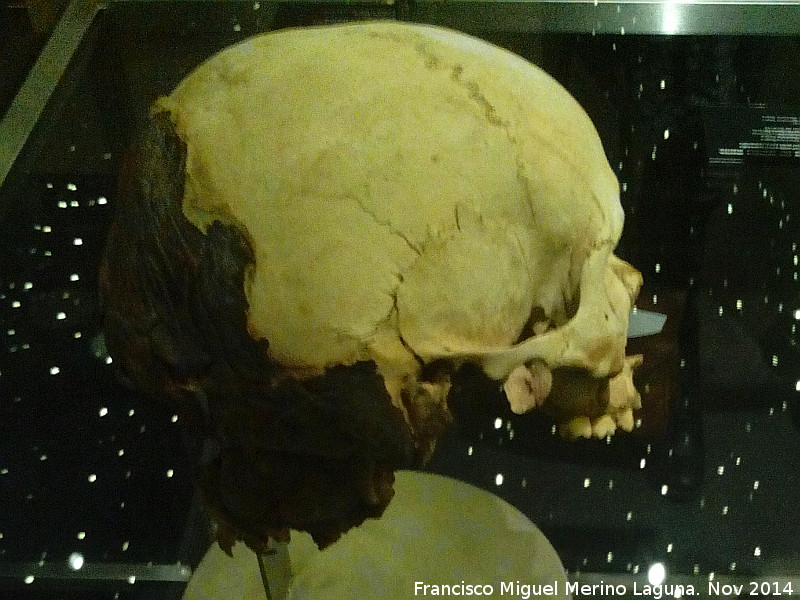 Museo Arqueolgico de Tenerife - Museo Arqueolgico de Tenerife. Crneo con parte momificado